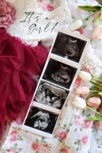 A picture of a dress, ultrasound pictures and tulips